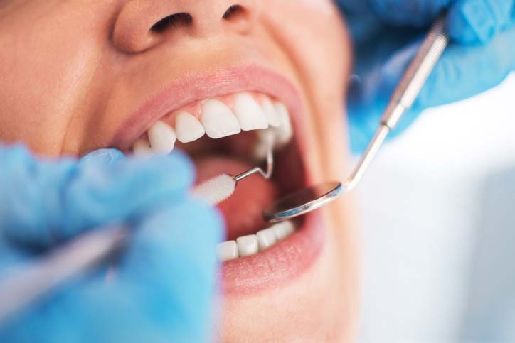Dental Checkup