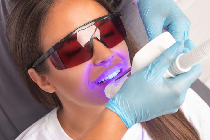 Teeth Whitening