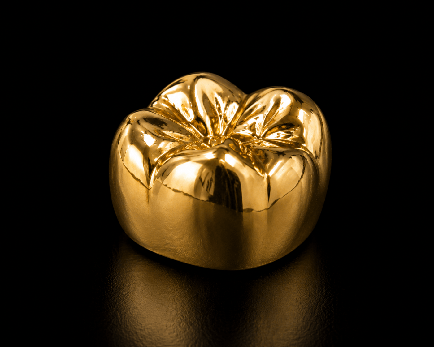 Full gold dental crown