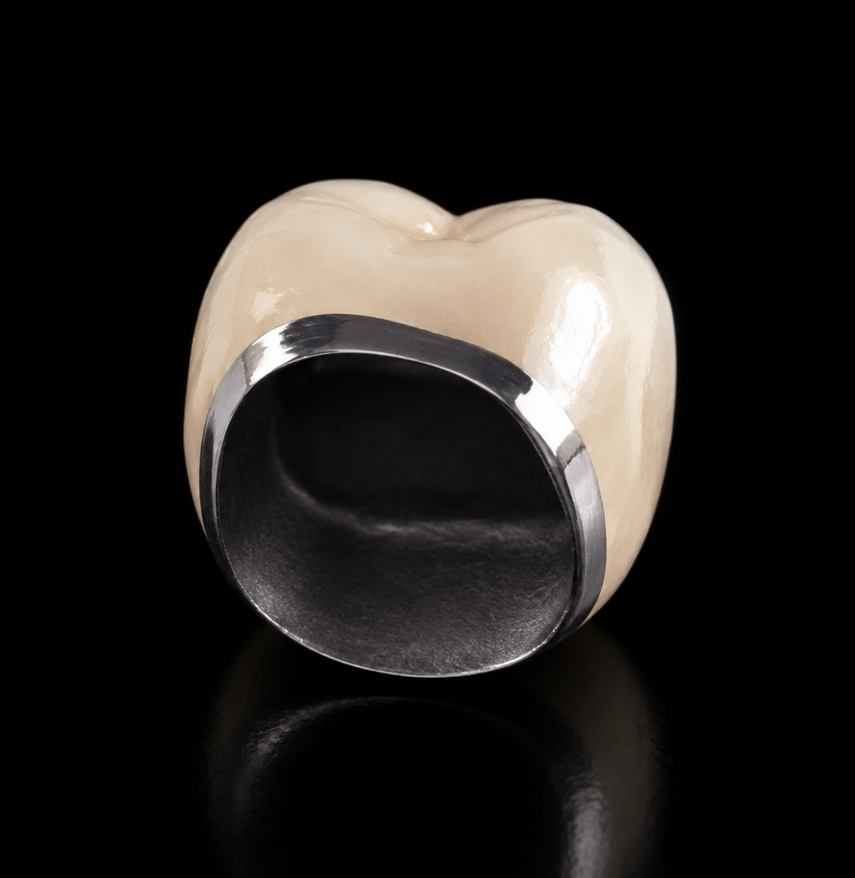 Porcelain fused to metal (PFM) crown