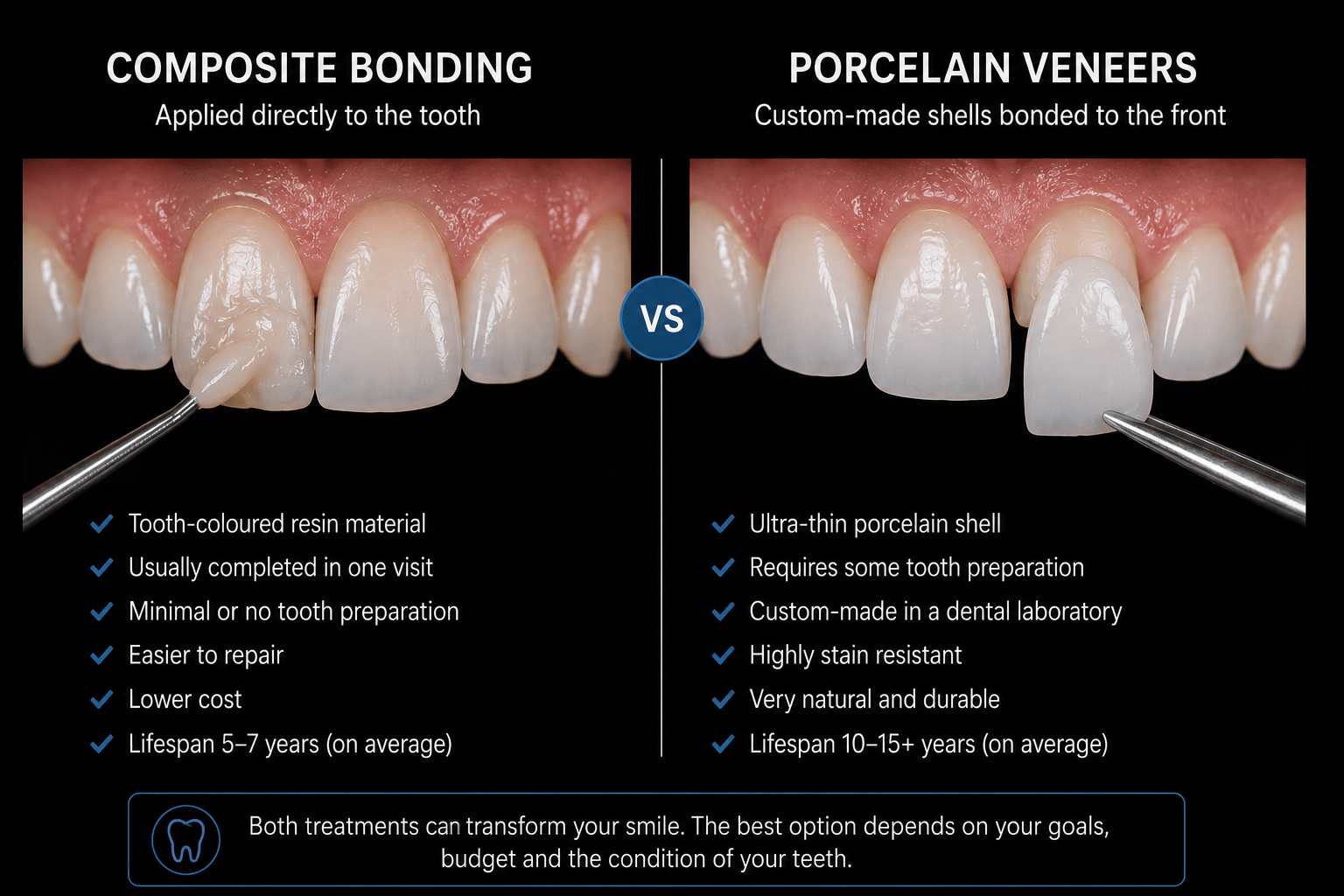 Composite bonding versus porcelain veneers — comparison of the two treatments
